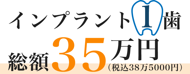 インプラント1歯 総額35万円(税込38万5000円)